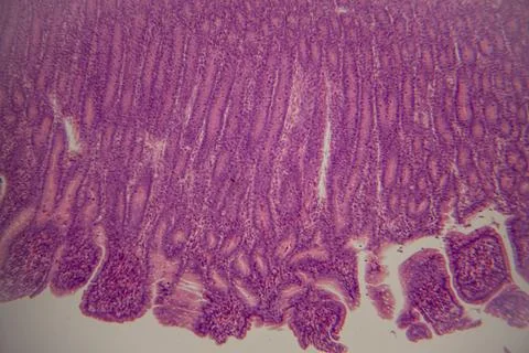 Microscopic view of human intestinal tissue section stained with hematoxyli.. Photos