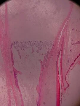 Microscopic View of Human Nail 스톡 사진