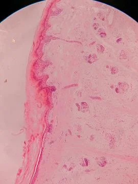 Microscopic View of Human Nail 스톡 사진