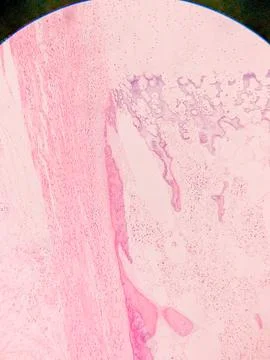 Microscopic View of Human Nail 스톡 사진