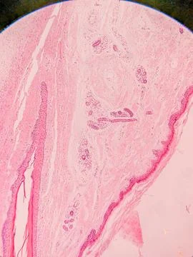 Microscopic View of Human Nail Foto stock