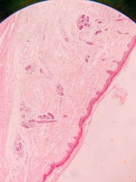 Microscopic View of Human Nail 스톡 사진