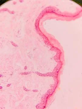 Microscopic View of Human Nail Stock Photos