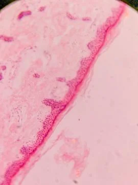 Microscopic View of Human Nail Stock Photos