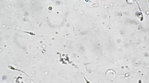 Microscopic view of human sperm. Highresolution imagery of sperm morphology Stock Footage 343952453