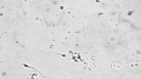 Microscopic view of human sperm. Highresolution imagery of sperm morphology Stock Photos