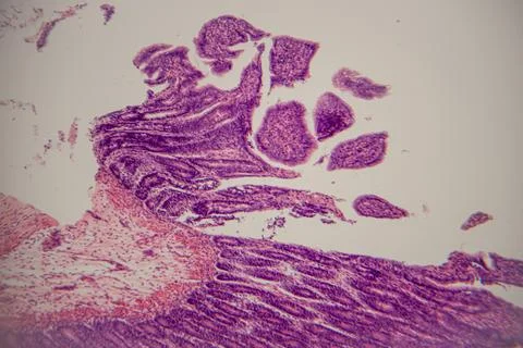 Microscopic view of human tissue sample stained with hematoxylin and eosin,.. Stock Photos
