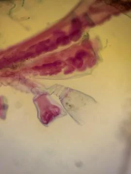 Microscopic View of a Hydra with Budding 스톡 사진
