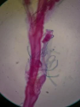 Microscopic View of a Hydra with Budding 스톡 사진