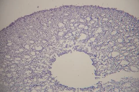 Microscopic view of lung tissue section showing alveoli structure with purp.. Stock Photos