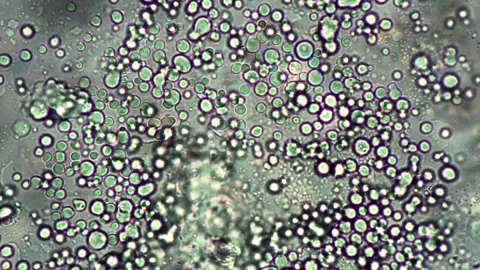 Microscopic View of Microbial Cells in a Scientific Laboratory Setting Vídeo Stock 341925998