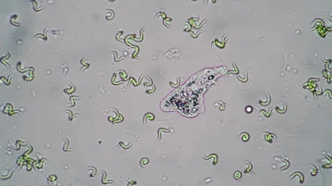 Microscopic View of Microorganisms and Bacteria with Spirals and Amoebas in.. Stock Footage 341925964