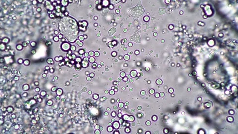 Microscopic View of Microorganisms with Vivid Patterns and Abstract Texture Stock Footage 341925996