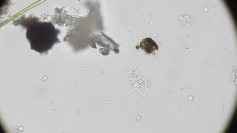 Microscopic view of moving amoeba in water sample, timelapse shows fast act.. Video stock 309513201