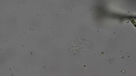 Microscopic view of moving amoeba in water sample, timelapse shows fast act.. Video stock 309769976