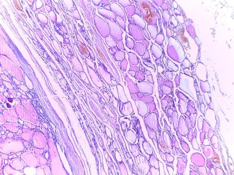 Microscopic View of Muscle Tissue Foto stock