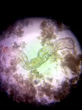 Microscopic View of Nematode Germs Showcasing Their Unique Structure and En.. Stock Photos