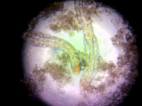 Microscopic View of Nematode Organisms in a Laboratory Setting for Scientif.. Stock Photos