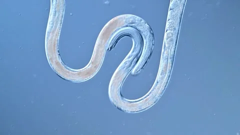 Microscopic view of nematodes moving under a high power microscope Stock Footage 334828964