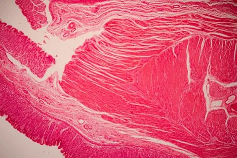 Microscopic view of a pink-stained tissue section with. 库存照片