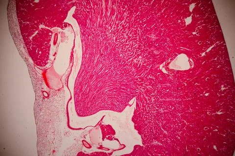 Microscopic view of a pink-stained tissue section with. Photos