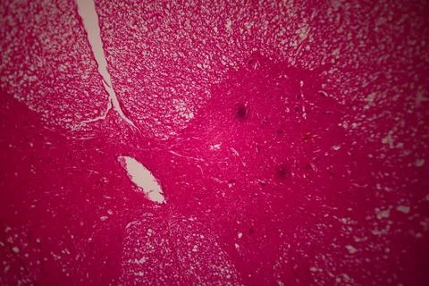 Microscopic view of a pink-stained tissue section with. Stockfoto's