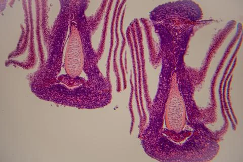 Microscopic view of plant tissue showing two flower buds with distinct cell.. Фото