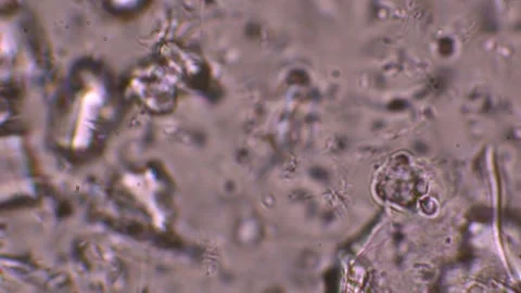 A microscopic view of a probiotic, 1000x magnification reveals crystals and.. Stock Footage 273478728