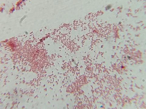 Microscopic View of Purple Cocci Bacteria Clustered in Grapelike Formation 스톡 사진