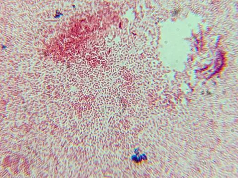 Microscopic View of Purple Cocci Bacteria Clustered in Grapelike Formation 스톡 사진