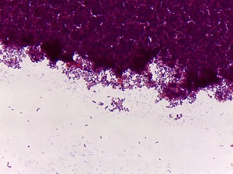 Microscopic view of a purple-stained sample 스톡 사진