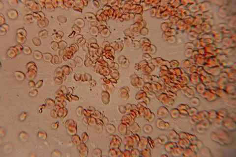 Microscopic view of red blood cells in a fluid medium, showcasing their uni.. Stock Photos