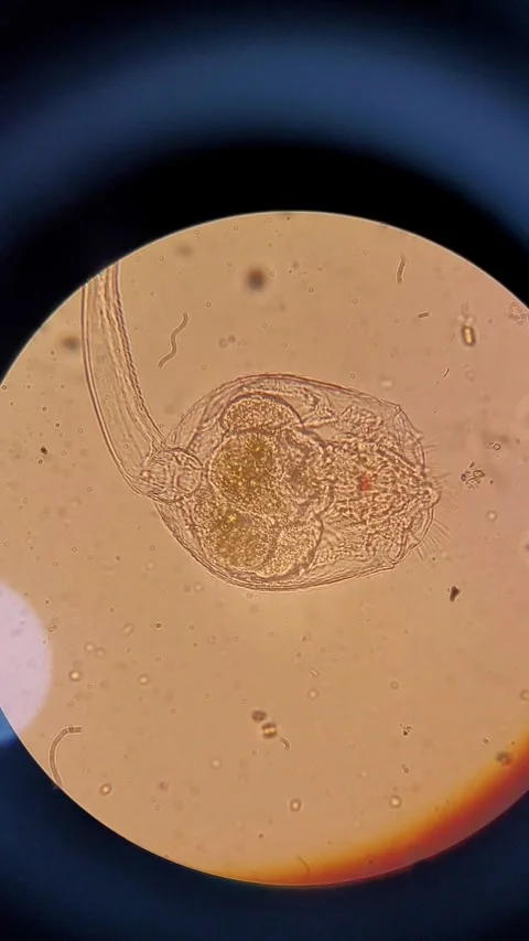 Microscopic view of Rotifer Vídeos de archivo 331446184