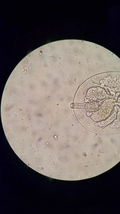 Microscopic view of Rotifer with visible internal eggs Vídeos de archivo 331446156