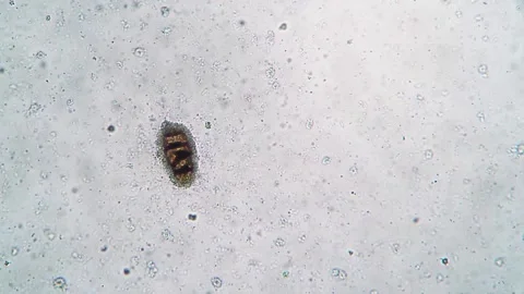 Microscopic View of a Single Specimen Surrounded by Clear Particles on a Wh.. Stock Footage 341925989