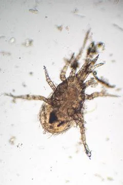 Microscopic View of a Soil Mite Arachnid Foto stock