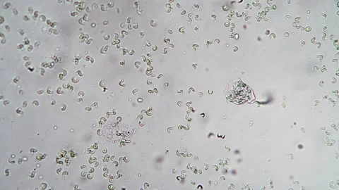 Microscopic View of Spirulina Algae in Clear Suspended Solution with Cellul.. Vídeos de archivo 341925991