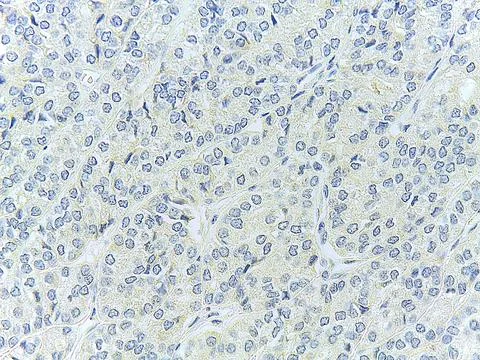 Microscopic view of stained tissue sample Stock Photos