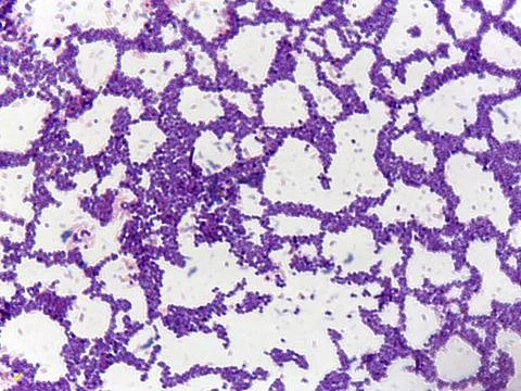 Microscopic view of stained tissue sample 스톡 사진