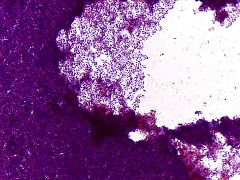 Microscopic view of textured surface Stock Photos