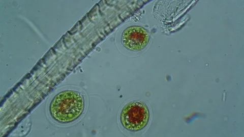 Microscopic view of unicellular green algae and a mold hypha Stock Footage 117273259