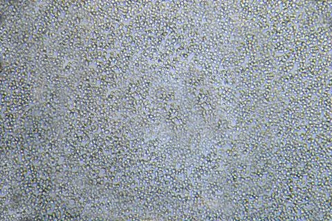 Microscopic view of yeasts cells Stock Photos