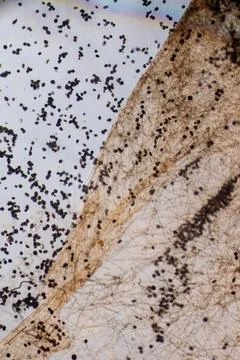 Microscopic Visualization of Darkly Pigmented Fungal Conidia and Hyphal Str.. 스톡 사진