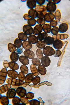 Microscopic Visualization of Darkly Pigmented Fungal Conidia and Hyphal Str.. Foto stock