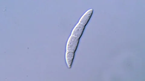 Microscopic Visualization of Fusarium Microconidia, 1000x Vídeos de archivo 317811745
