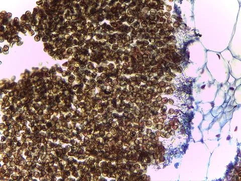 Microscopic Visualization of Ustilago Zeae Corn Smut Teliospores and Fungal.. 스톡 사진