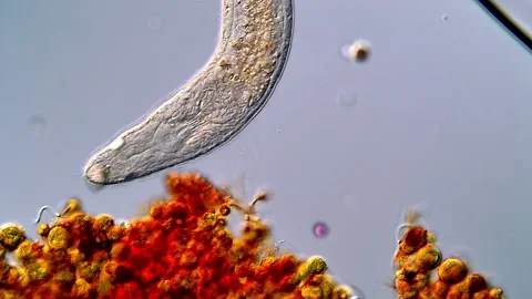Microscopic World of Flatworm – 4K video 스톡 동영상 317210980
