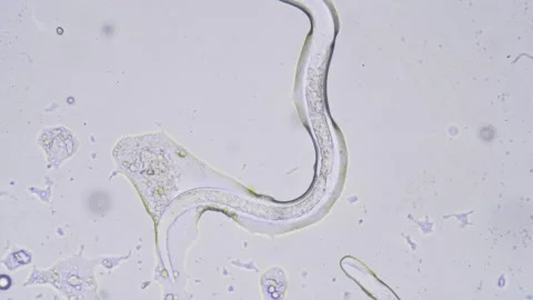 The Microscopic World. Nematode or roundworm. Stock-Footage 221419111