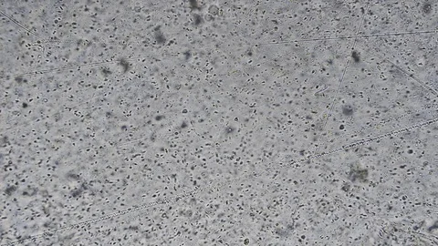 The Microscopic World. Sperm under the microscope. Stock Footage 82800344