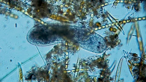 Microscopic worm swims through algae Stock Footage 100860854